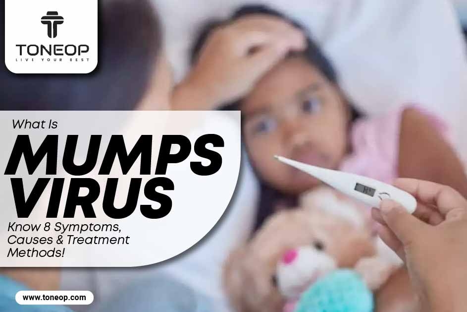 What Is Mumps Virus? Know 8 Symptoms, Causes And Treatment Methods! 