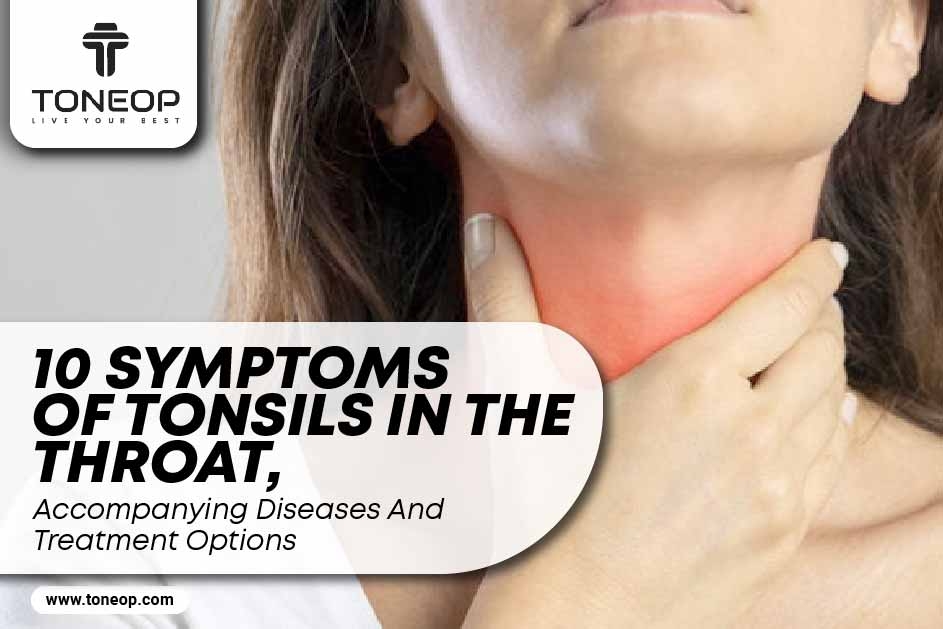 10 Symptoms Of Tonsils In The Throat, Accompanying Diseases And Treatment Options 