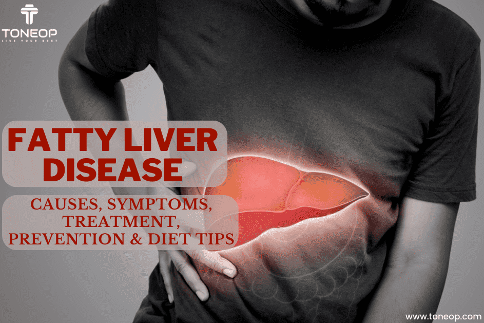 Fatty Liver Disease: Causes, Symptoms, Treatment, Prevention And Diet Tips!