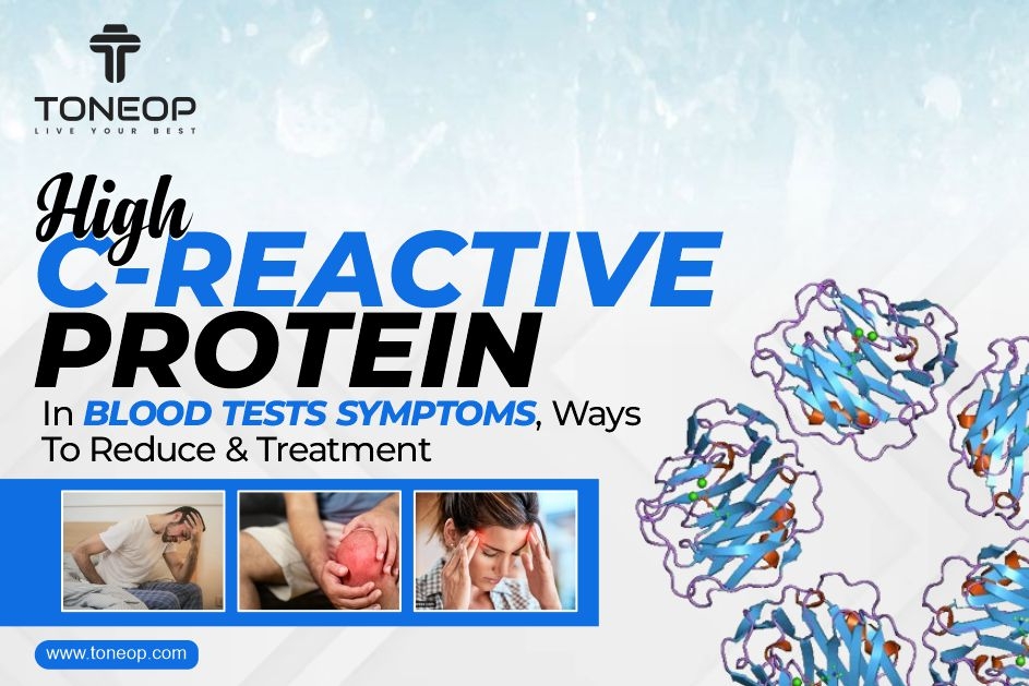 High C-Reactive Protein In Blood Tests: Symptoms, Ways To Reduce & Treatment 	