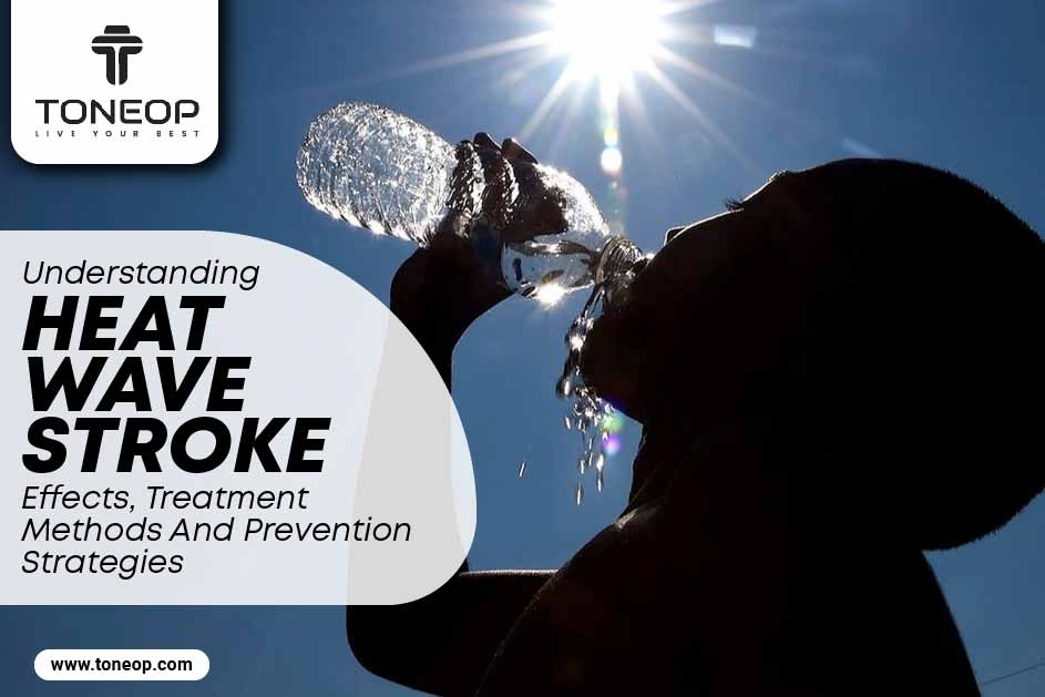 Heat Wave Stroke In Summers: Effects, Treatment Methods And Prevention Strategies 