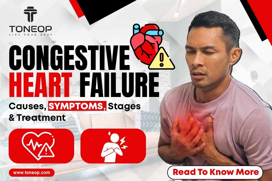 Congestive Heart Failure Causes, Symptoms, Stages And Treatment