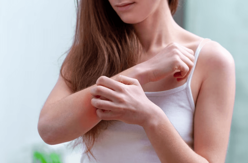 Skin Allergies By Food: Symptoms Causes And Treatment