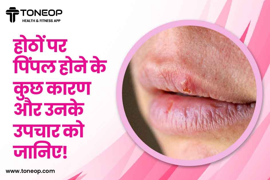 होठों पर पिंपल होने के कुछ कारण और उनके उपचार को जानिए!