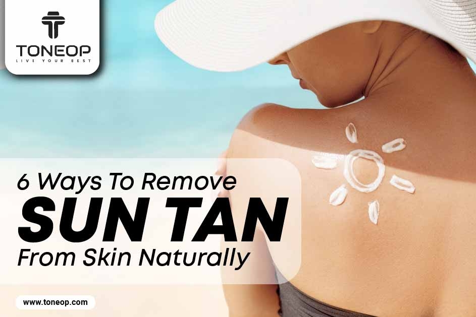6 Proven Ways To Remove Sun Tan From Skin Naturally  