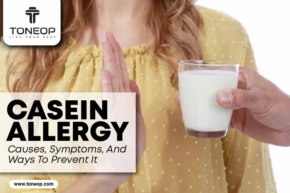 Casein Allergy: Causes, Symptoms, And Ways To Prevent It