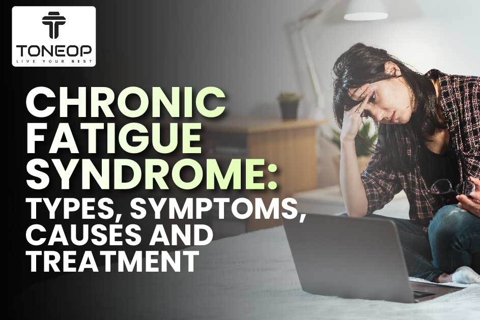 Chronic Fatigue Syndrome: Types, Symptoms, Causes And Treatment