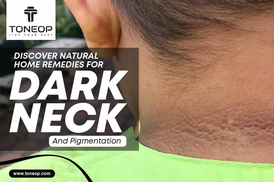 Discover Natural Home Remedies For Dark Neck And Pigmentation 