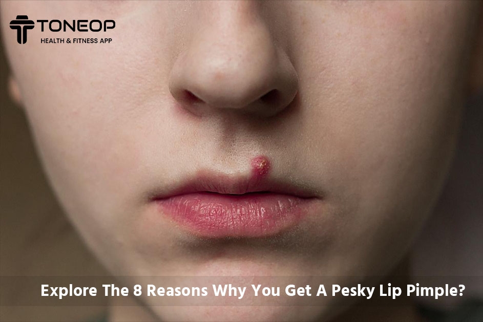 Explore The 8 Reasons Why You Get A Pesky Lip Pimple?