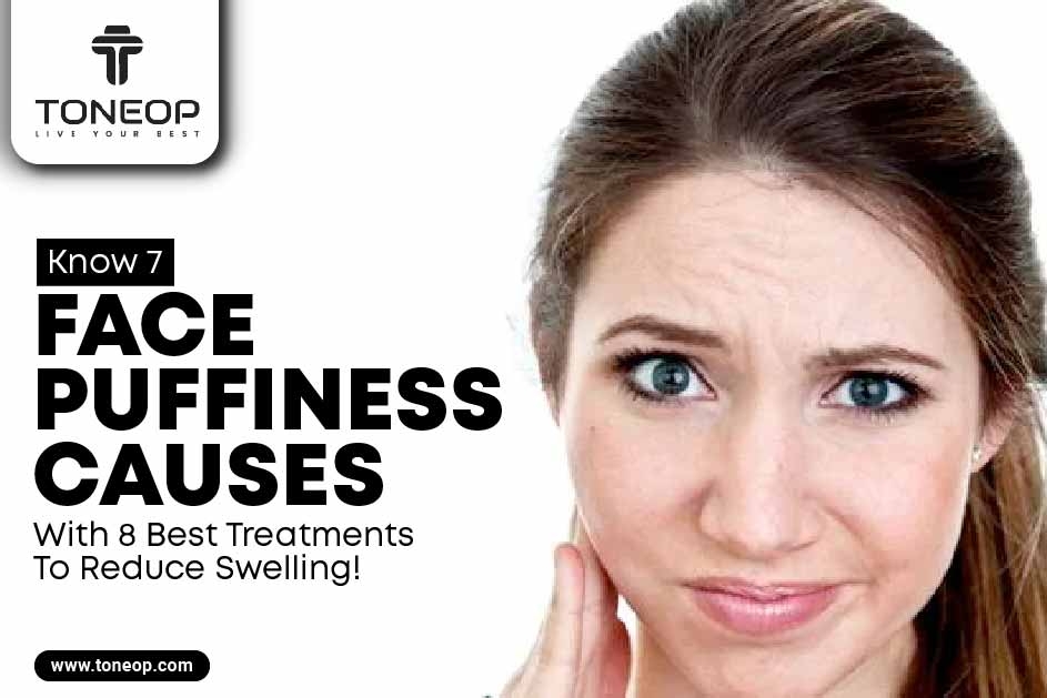 Know 7 Face Puffiness Causes With 8 Best Treatments To Reduce Swelling! 