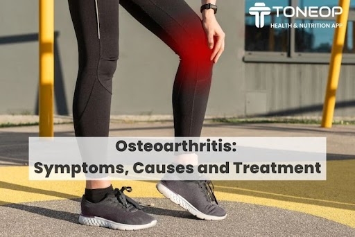Osteoarthritis: Symptoms, Causes and Treatment