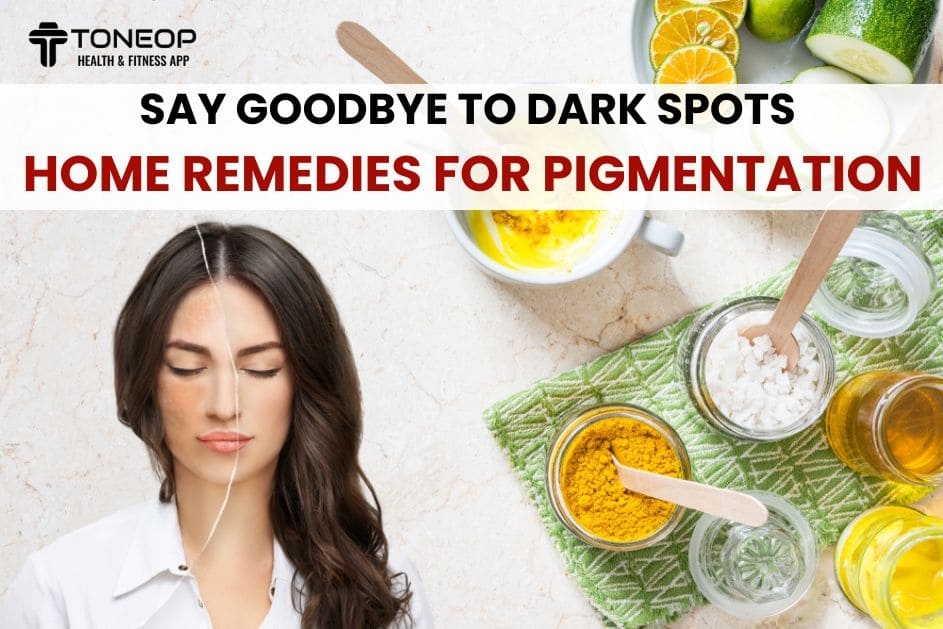 Say Goodbye To Dark Spots: Home Remedies For Pigmentation