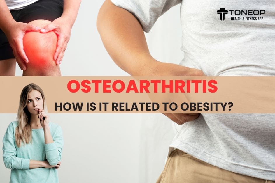 Osteoarthritis: How Is It Related To Obesity?