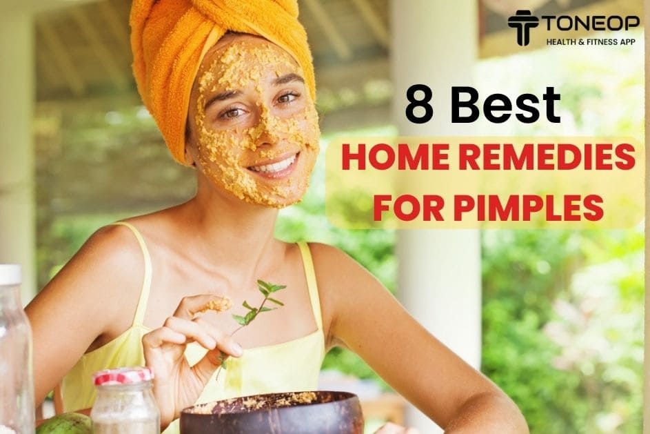 8 Best Home Remedies For Pimples
