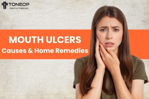 Mouth Ulcers: Causes And Home Remedies